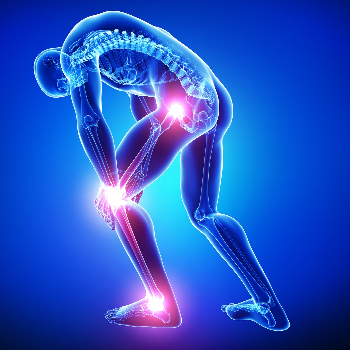 Tennant Biomodulator for chronic intractable pain HipKneeAnklePain